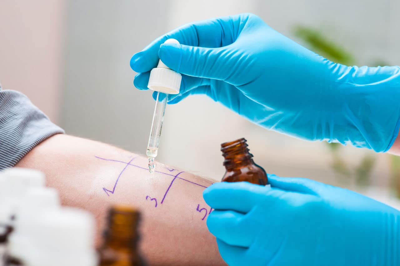 Test dépistage des allergies