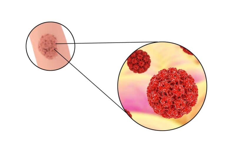 Zoom sur une représentation du virus du papillome humain (HPV)