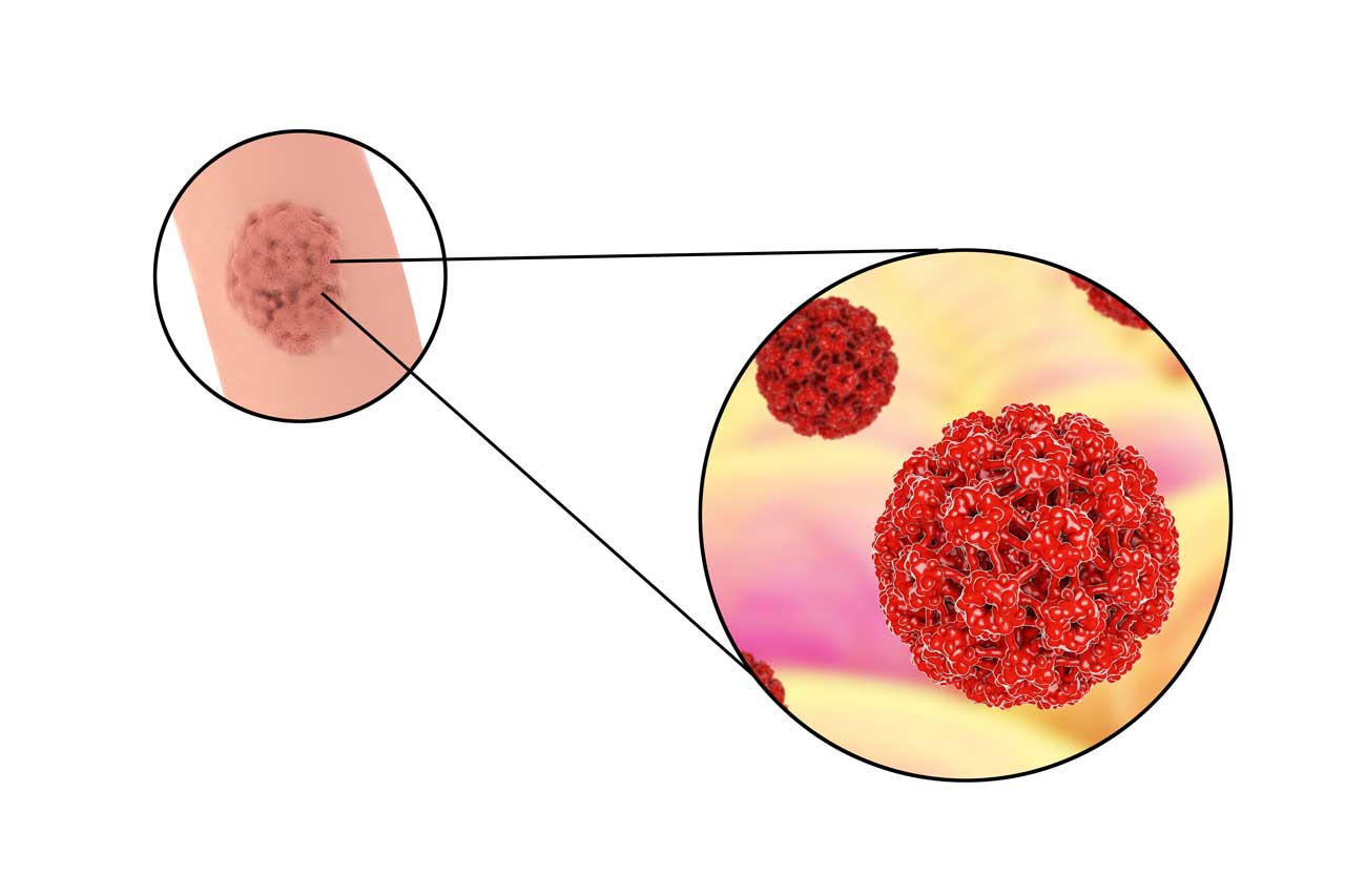 Zoom sur une représentation du virus du papillome humain (HPV)